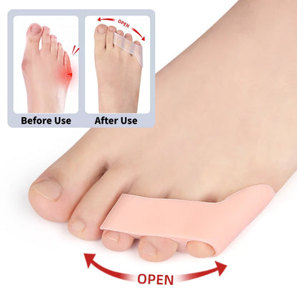 Hallux Valgus Corrector Toe Separator